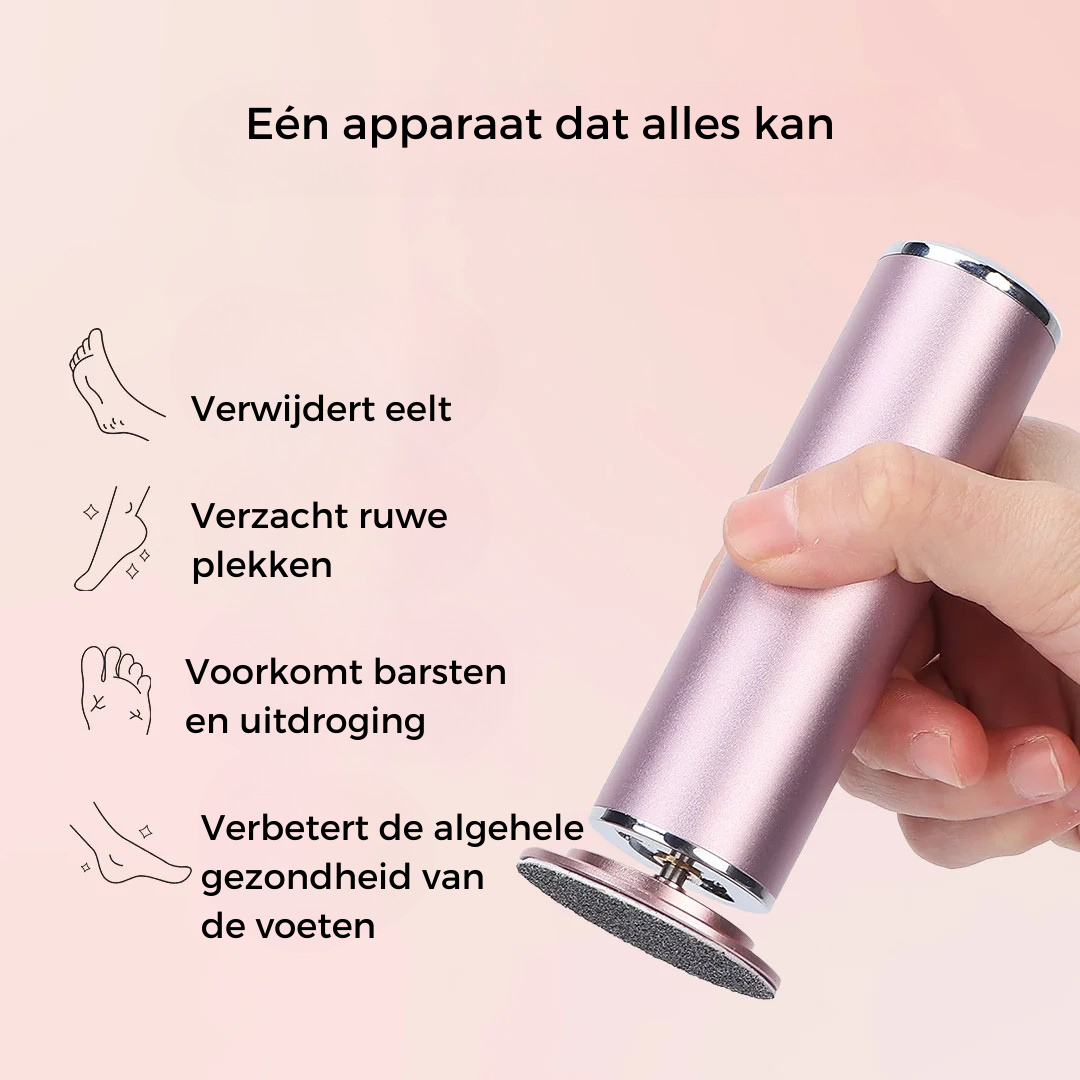 SmoothStep™ - Elektrische Eeltverwijderaar