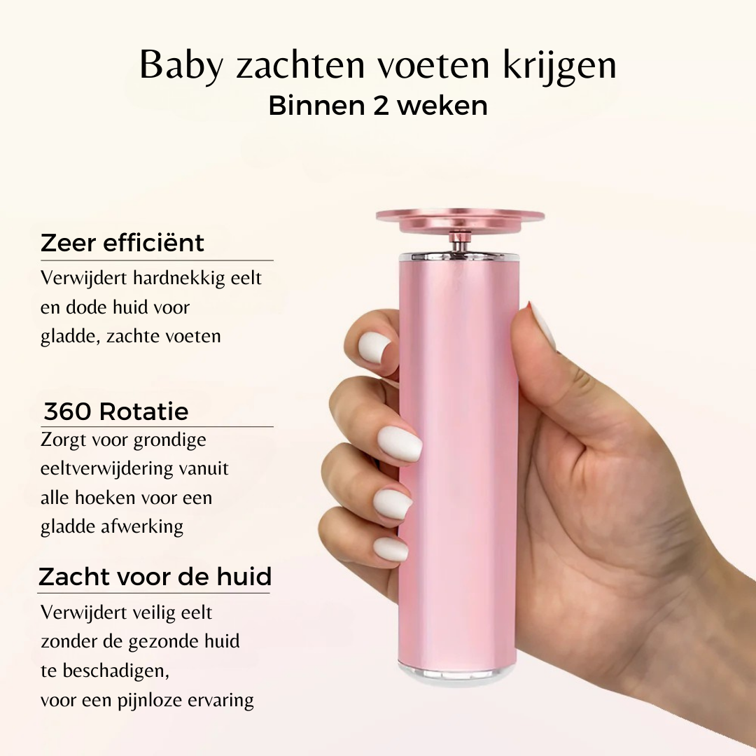 SmoothStep™ - Elektrische Eeltverwijderaar